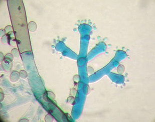 Description: The fungus, Botrytis cinerea Tags: The fungus, Botrytis cinerea