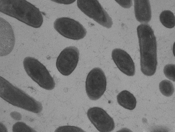 Description: Listeria monocytogenes Tags: Listeria monocytogenes
